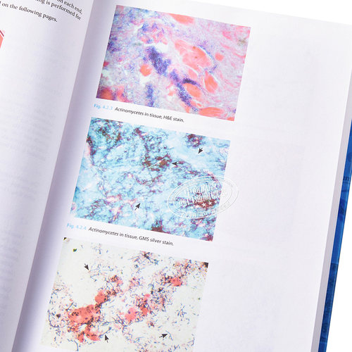 现货 临床重要真菌图册 Atlas Of Clinically Important Fungi Carmen Sciortino 英文原版【中商原版】wiley - 图2