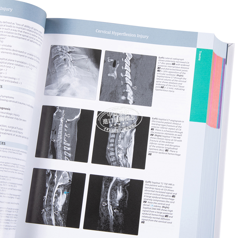 现货 诊断成像 脊柱 第4版 英文原版 Diagnostic Imaging Spine Jeffrey S Ross Kevin R Moore【中商原版】Elsevier - 图2