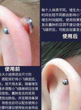 防增生小飞碟耳骨钉舌钉硅胶垫片