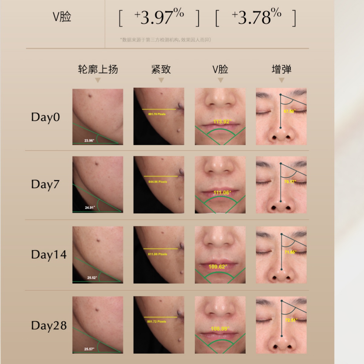 新品INNO英诺皮肤世家微颜紧塑精华液V脸小棕瓶小脸素咖啡因肉碱 - 图3
