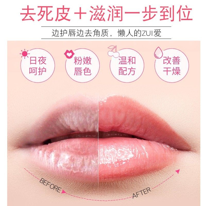  新生活国际唇膜