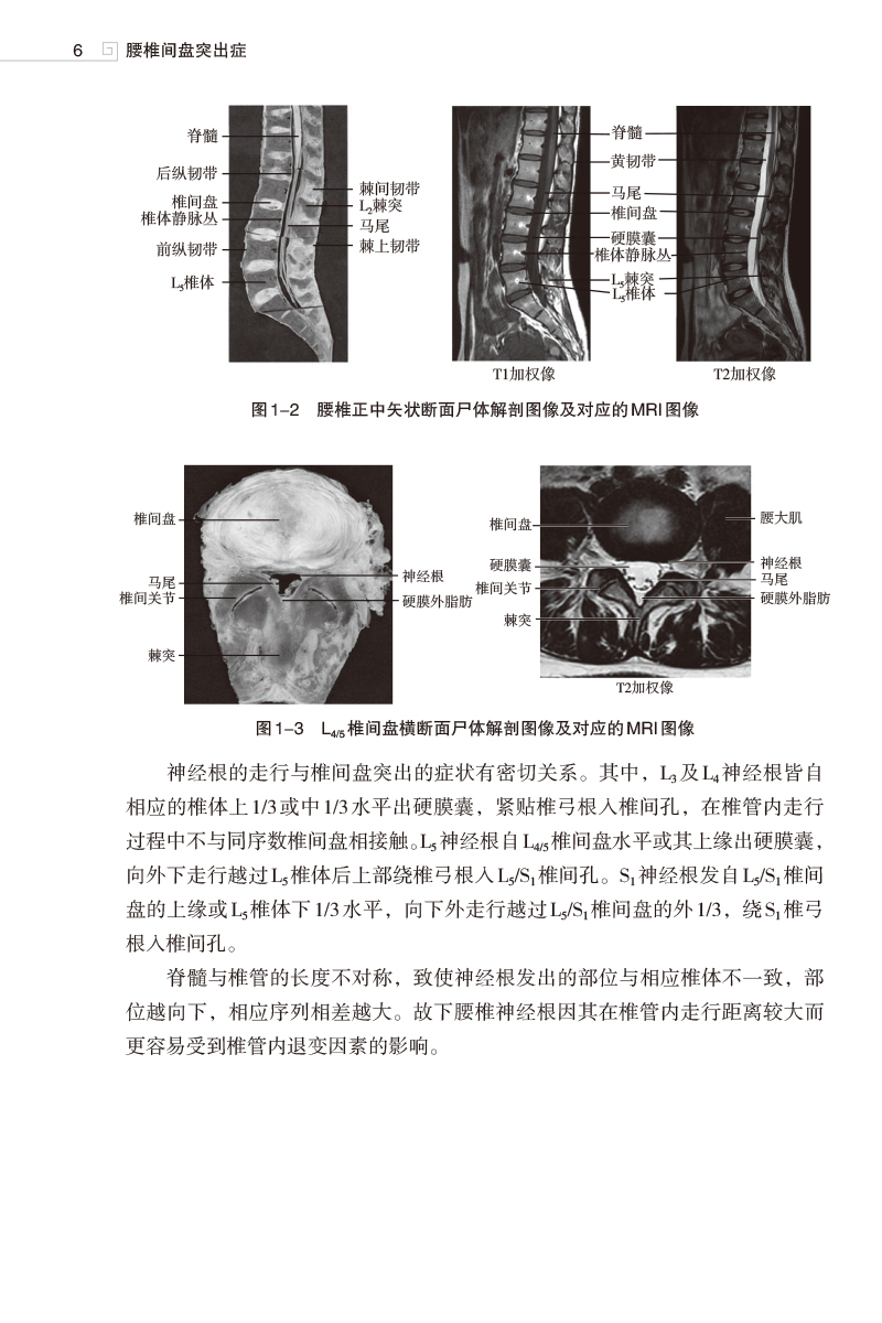 腰椎间盘突出症 常见病针灸临床丛书 蒋亚文 顾纯 中医针灸治疗疾病临床经验作用机制及疗效特点 中国医药科技出版社9787521439403 - 图2