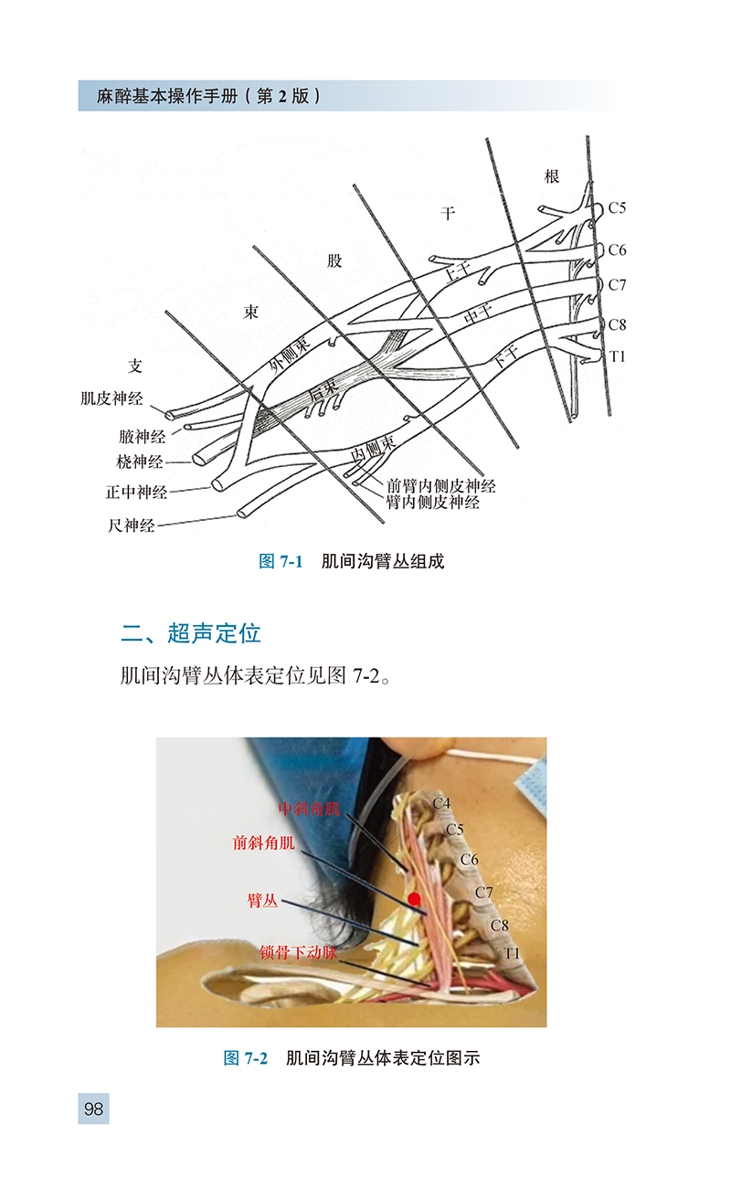 麻醉基本操作分册 第2版 冯艺主编 附视频 临床麻醉系列丛书 临床常用麻醉基本操作 零基础入门 北京大学医学出版社9787565927461 - 图2