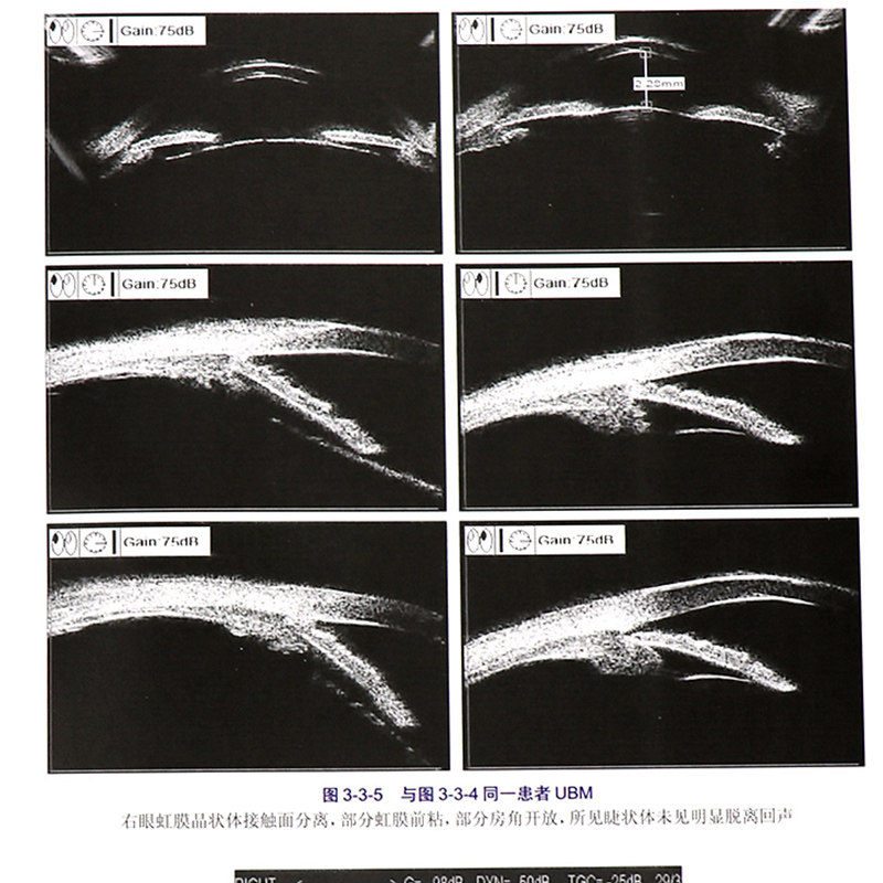 图说视觉电生理 图说眼科检查系列丛书眼科学李世迎阴正勤主编广大眼科医生和技师参考人民卫生出版社9787117292467