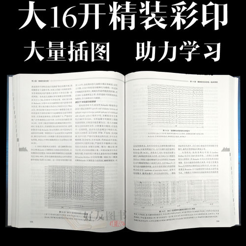 正版临床脑电图学第2版人卫版刘晓燕主编人民卫生出版社第二版临床脑电图学脑电图西医临床脑电图专业学习指导用书-图1