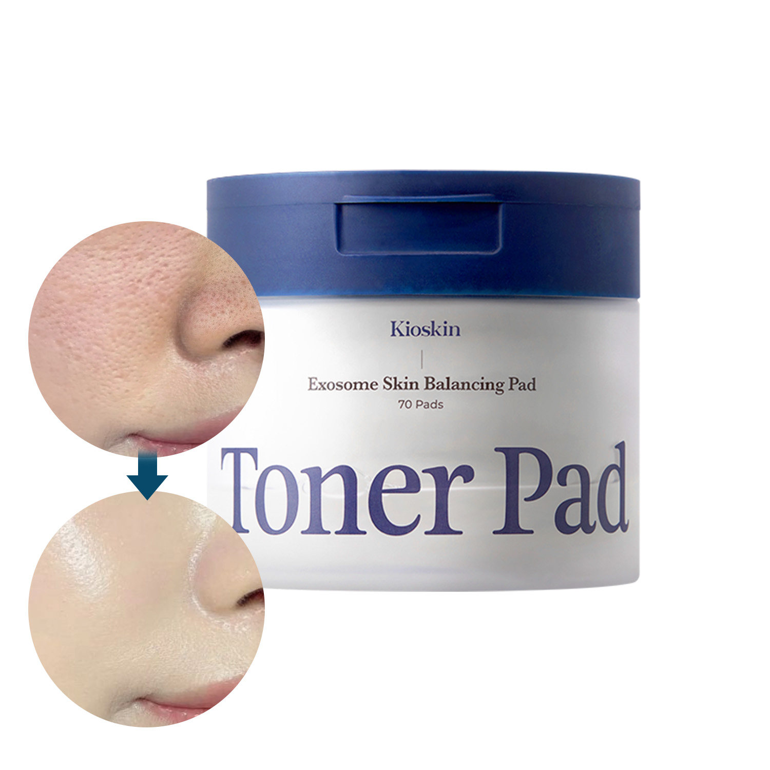 现货韩国原装湿敷棉精华棉片补水缩小毛孔去黑白头细腻肌肤积雪草,淘宝优惠券,粉丝福利购,淘宝优惠卷