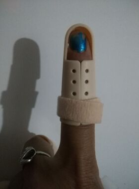 骨折保护肌腱断裂矫正器护指手指