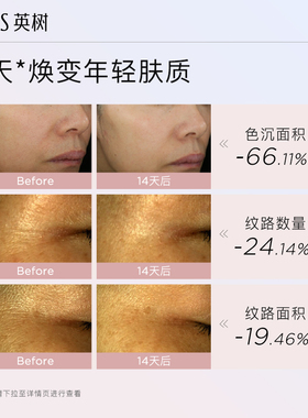 英树白梅花精华补水细腻毛孔提亮