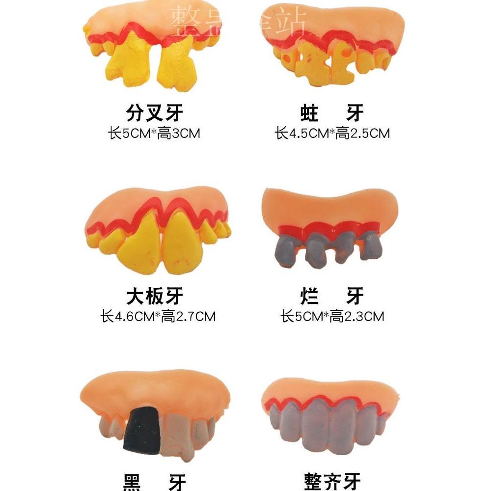 直播短视频恶搞笑假牙套愚人节网红搞怪牙齿搞笑道具龅牙仿真牙套-图1