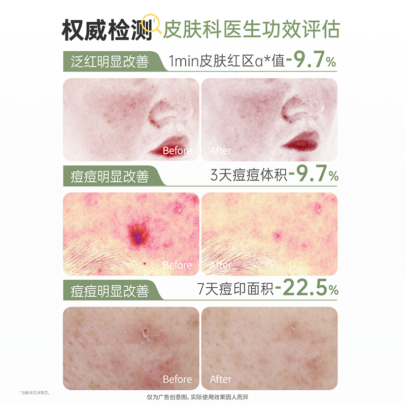 【官方正品】袋鼠妈妈青少年祛痘棉片湿敷精华液控油改善泛红护肤,淘宝优惠券,粉丝福利购,淘宝优惠卷