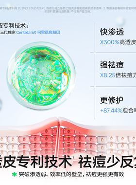 海龟爸爸祛痘精华液次抛急救瘪痘