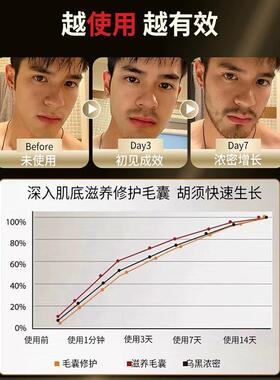 胡须胡子增长液眉毛生长液神器浓密毛发胸毛鬓角发际线膏男女生眉