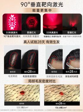 艾诗摩尔红光生髪梳33束激光密发仪育发生发仪健梳子头发护理仪器