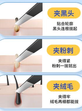 细胞夹黑头夹镊子毳毛眉毛夹粉刺针美容院高精密工具拔胡子夹专用