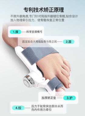 脚趾矫正器分趾器大拇指外翻脚骨纠正拇指分离大母指头男女士姆趾