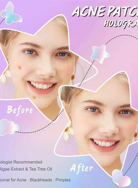 Invisible Acne Patches Removal Pimple Anti-Acne Hydrocolloid