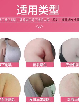 热销副乳贴消除腋下淋巴结去副乳神器消淋巴疏通乳腺耳后肿大散结