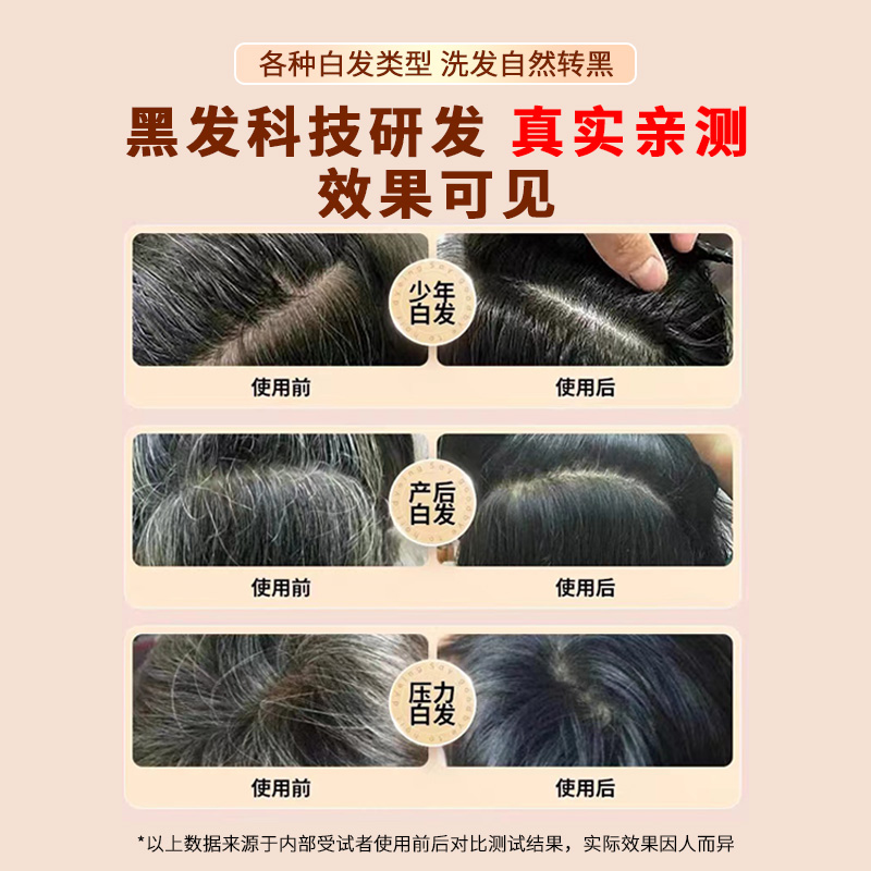 青丝漾黑灵芝白转黑根源黑发中y老年草本植物自然滋养洗发水生发 - 图0