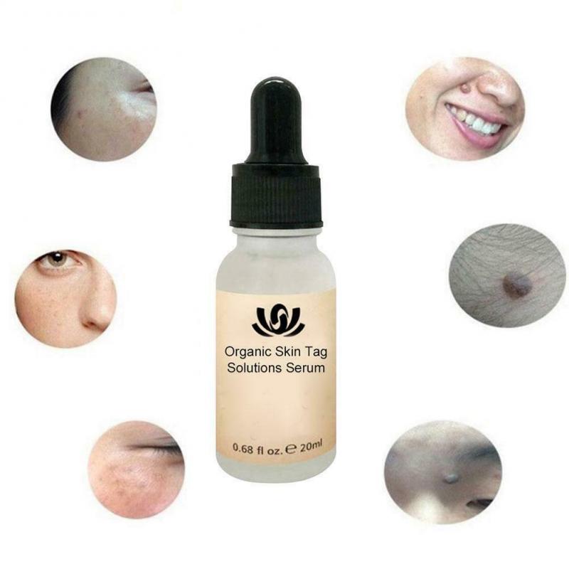 新品Organic Tags Solutions Serum Painless Mole Skin Dark Spo - 图1