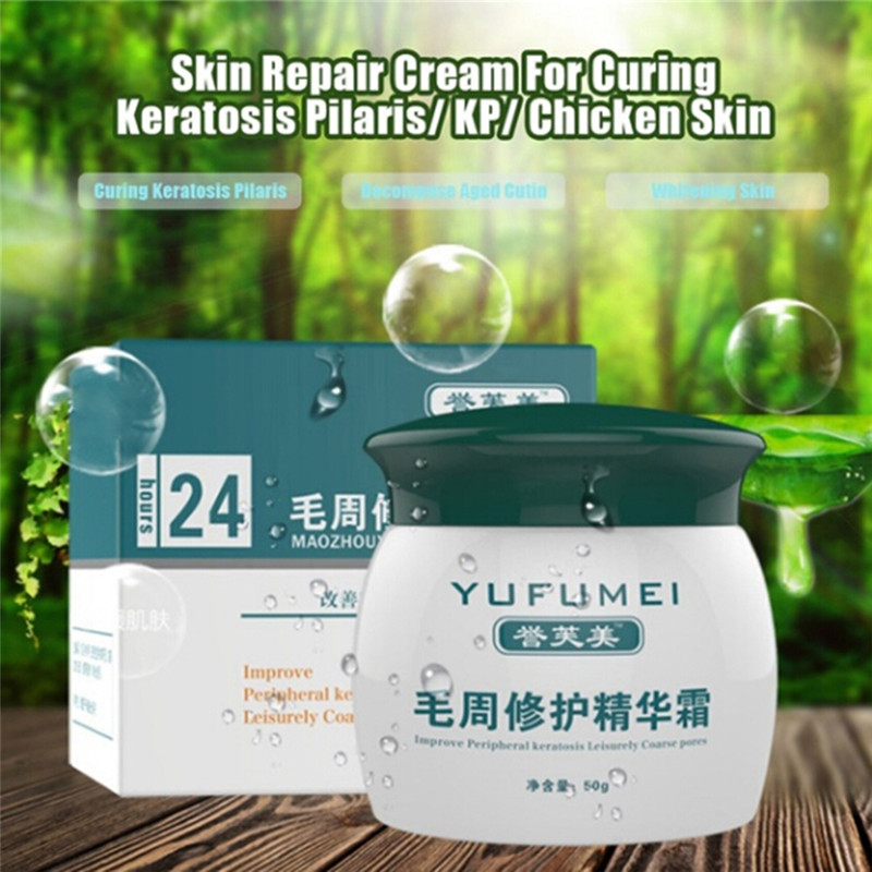 速发Malic Acid Treatment Body Ichthyosis Leg Keratosis Folli - 图1