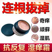 Zisheng Hall Volu Precious Cow Leather Moss Tinea Silver Stop Scrap Adult External head Ointment Skin Pruritus Cream Cream