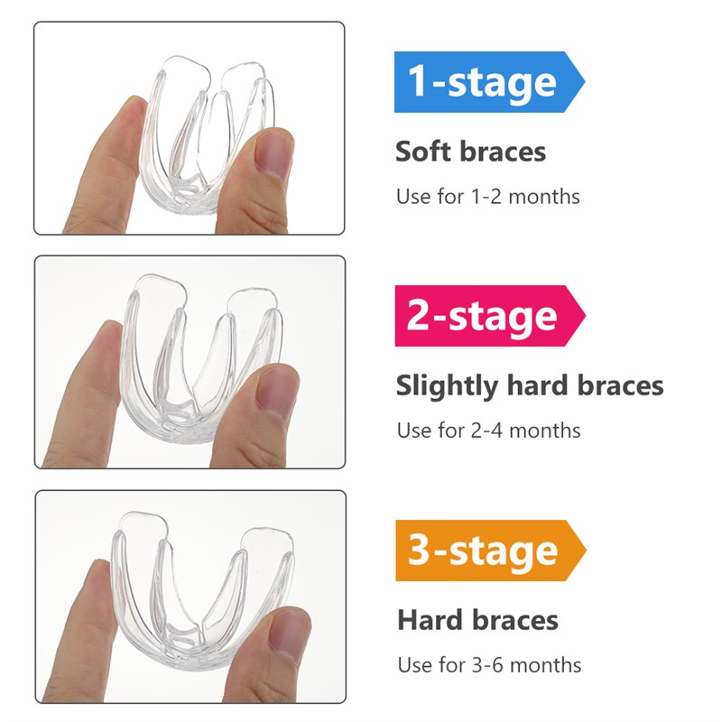 速发3pcs/set Dental Braces for Teeth Straightener Orthodonti - 图2