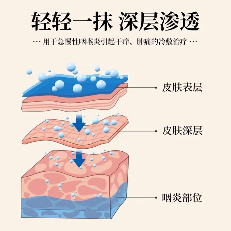 极速咽扁舒软膏李时珍官方正品冷敷治喉咙疼型康烟搭咽喉肿痛干咽 - 图1