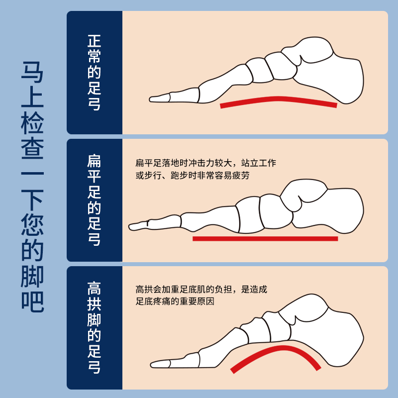 【自营】日本足弓垫扁平足支撑矫形器儿童支撑鞋垫进口矫正运动 - 图1