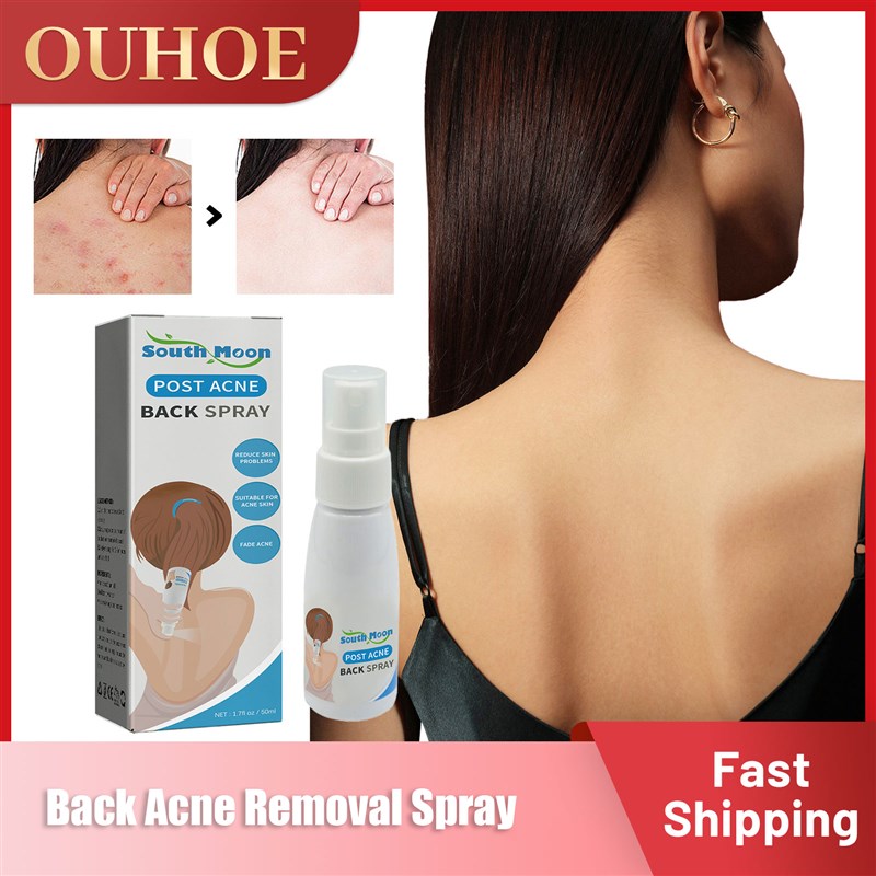 推荐Back Acne Treatment Spray Redness Calm Soothe Pores Shri-图0