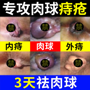 云南本草痔疮膏内痔外痔断混合痔神器消肉球肛裂去肉球特效非药膏