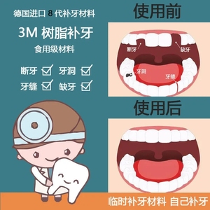 自己临时补牙材料遮盖牙缝缺牙门牙仿真自制假牙套烤瓷牙填牙洞贴