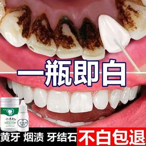 牙齿美白洗牙粉去黄烟渍结石清洁洗黑污垢除牙石洗白洁牙白牙神器