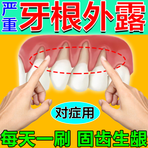 日本牙龈萎缩牙周炎专用牙膏修复牙齿松动护理出血肿痛消焱非喷剂