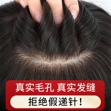 Sky Tree Needle Handing Wig for Women: Top Cover White Hair, True Hair, Full Human Hair, Hair Increase, Fluffy and Traceless Hair Patch