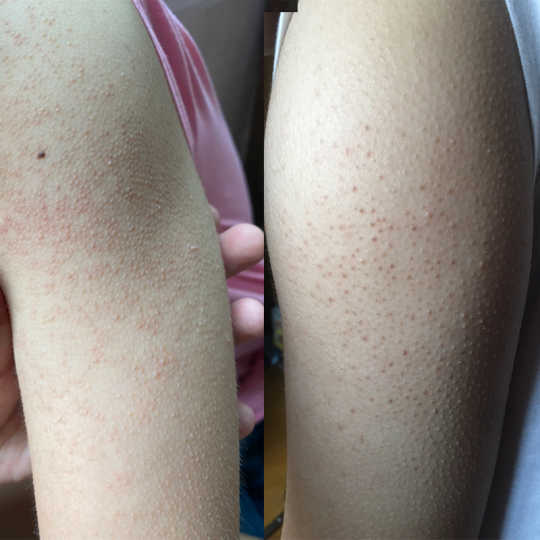 21 手臂鸡皮肤人气热卖榜推荐 淘宝海外