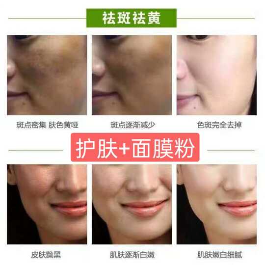 祛色素沉着斑价格 祛色素沉着斑系列 祛色素沉着斑怎么样 好用吗 淘宝海外