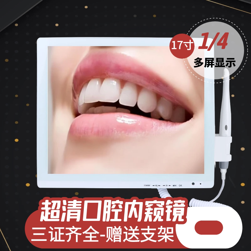 HD Intraoral Camera (Wireless)