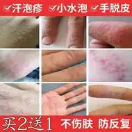 手上有小水泡新品 手上有小水泡价格 手上有小水泡包邮 品牌 淘宝海外