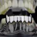 Platinum tipped lower teeth