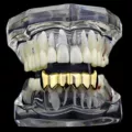 Golden Pointed Lower Teeth