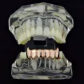 Rose Gold Pointy Lower Teeth