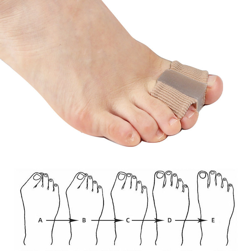 Orthosis Fiber Double-Hole Toe Separator Separator Foot Bone Overlapping Toe Thumb Men and Women Valgus Toe Set Toe Large