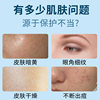 Fu Shi Ting Niacinamide Gel Arbutin Brightening Skin Color Hydrating Moisturizing Fading Pockmarks Dark Yellow Face Cream