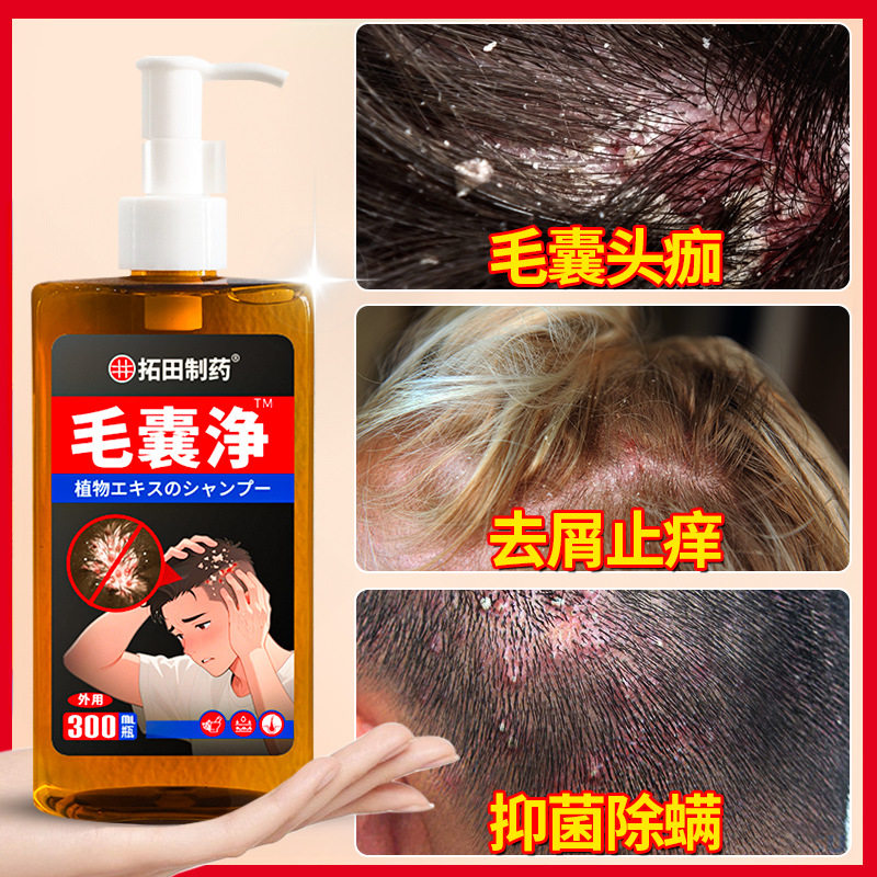 Tuotian Pharmaceutical Hair Follicle Cleansing Shampoo Removes Acne, Removes Mites, and Controls Oil. Shampoo Is Suitable for Both Men and Women