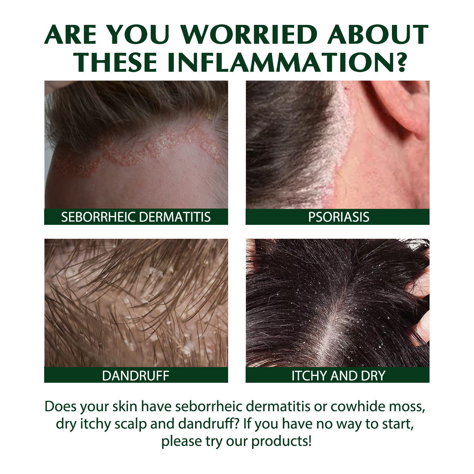 South Moon Scalp Care Shampoo Hair Oil Control Scalp Cleansing Anti-Dandruff Care Itch Refreshing Repair