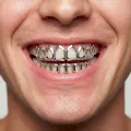 Hollow silver 8-tooth flat teeth (set)