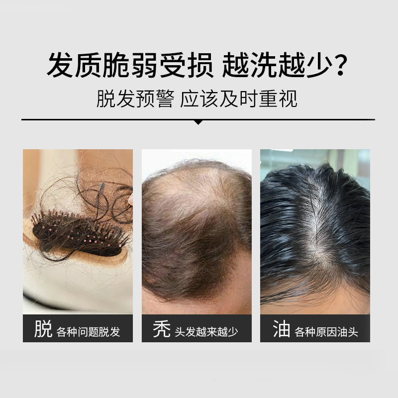 Cross-border Explosions Ginger Essence Oil Control Anti-dandruff Shampoo Anti-dandruff Soft Nourishing Hair Care Shampoo Wholesale