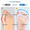 Sebs Wearable Shoe Thumb Orthosis Five-Hole Chain Foot Bone Valgus Toe Corrector Toe Overlapping Toe Separator