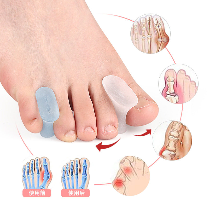 Sebs Thumb Valgus Toe Overlapping Toe Orthosis Soft Toe Separator Foot Separator