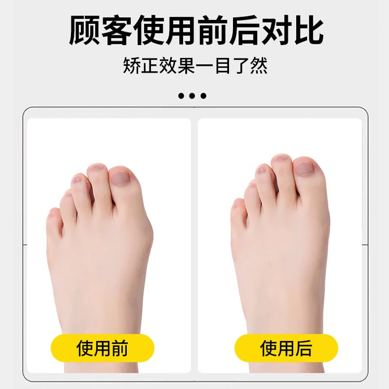 Toe Thumb Valgus Corrector Toe Separator for Men and Women Toe Separator